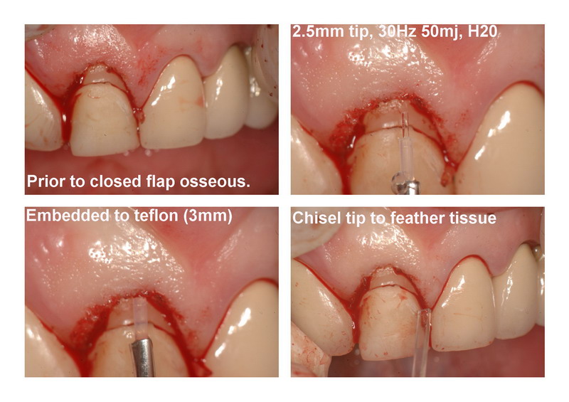 RR patient page 4_resize.jpg